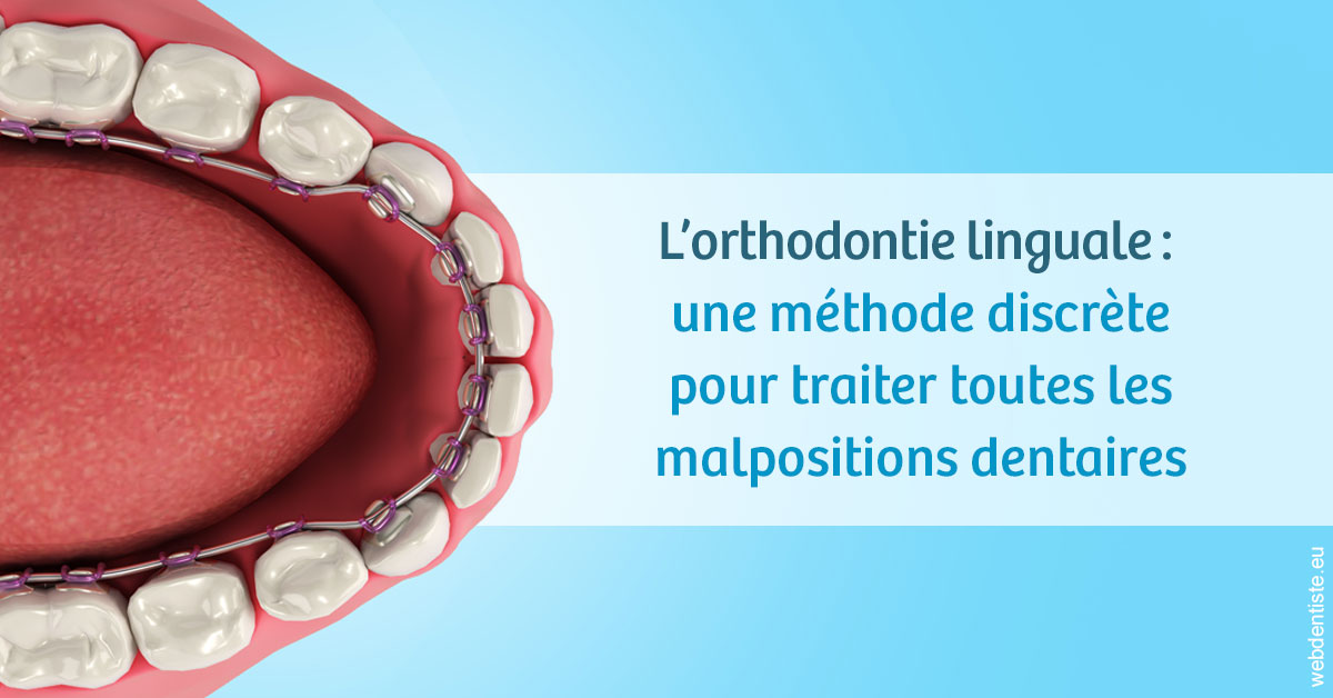 https://selarl-dr-valette-jerome.chirurgiens-dentistes.fr/L'orthodontie linguale 1