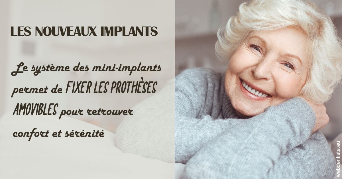 https://selarl-dr-valette-jerome.chirurgiens-dentistes.fr/Les nouveaux implants 1