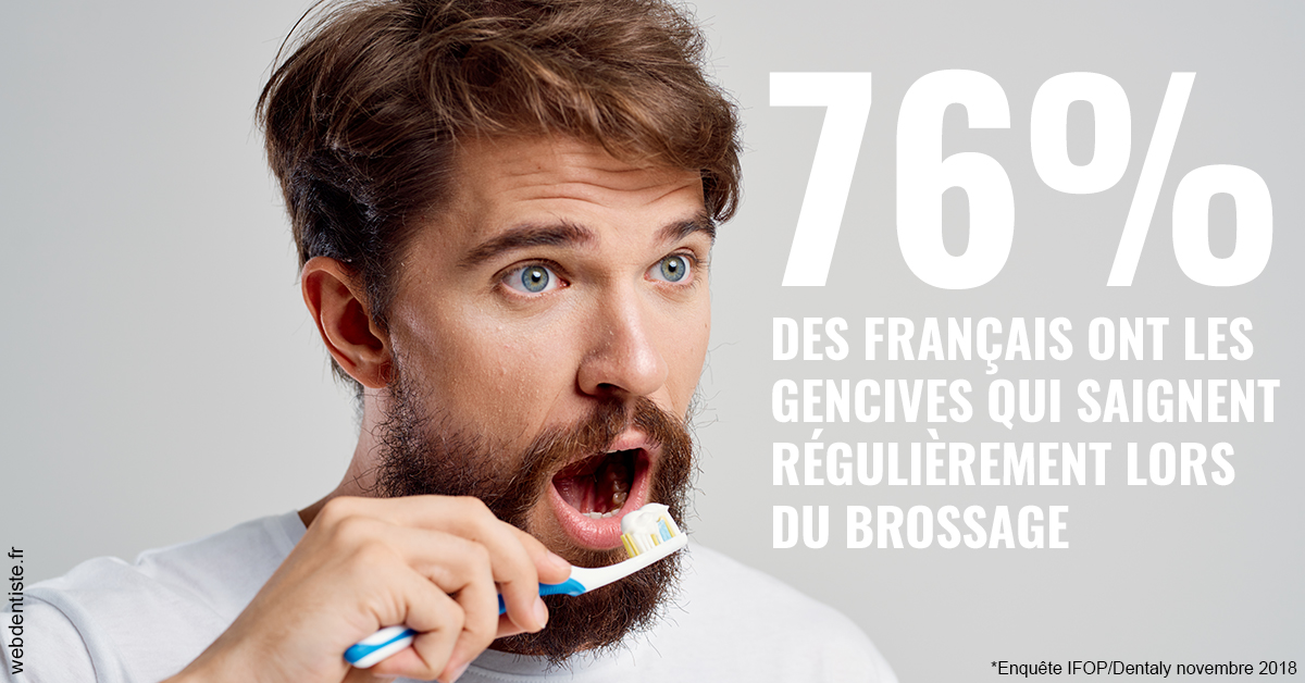 https://selarl-dr-valette-jerome.chirurgiens-dentistes.fr/76% des Français 2