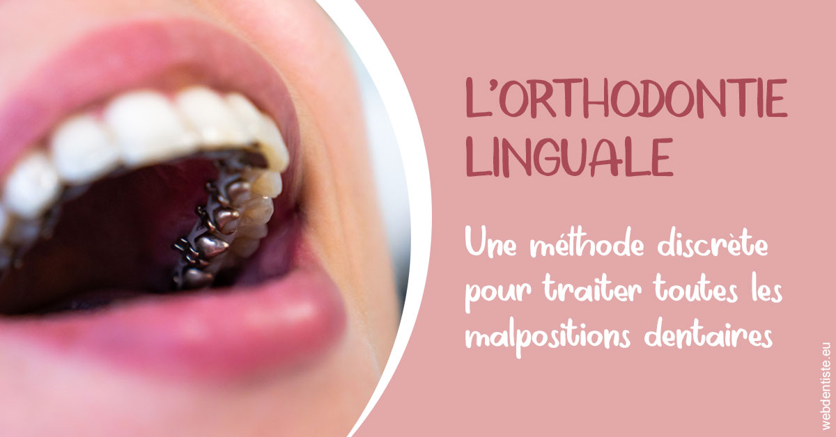 https://selarl-dr-valette-jerome.chirurgiens-dentistes.fr/L'orthodontie linguale 2
