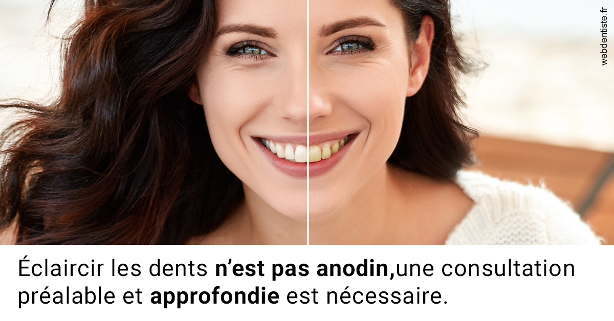 https://selarl-dr-valette-jerome.chirurgiens-dentistes.fr/Le blanchiment 2