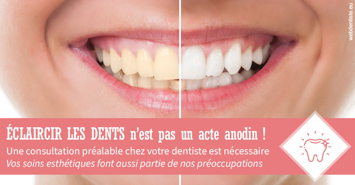 https://selarl-dr-valette-jerome.chirurgiens-dentistes.fr/Eclaircir les dents 1