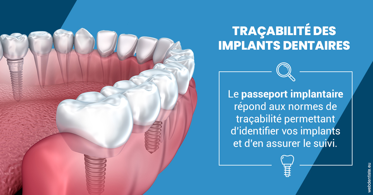 https://selarl-dr-valette-jerome.chirurgiens-dentistes.fr/T2 2023 - Traçabilité des implants 1