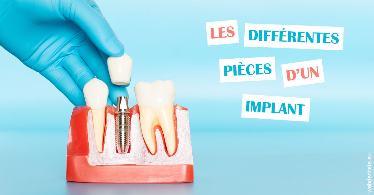 https://selarl-dr-valette-jerome.chirurgiens-dentistes.fr/Les différentes pièces d’un implant 2