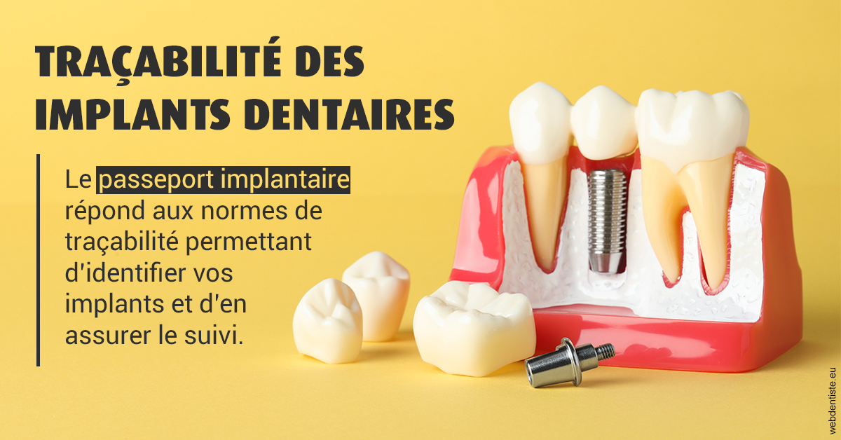 https://selarl-dr-valette-jerome.chirurgiens-dentistes.fr/T2 2023 - Traçabilité des implants 2