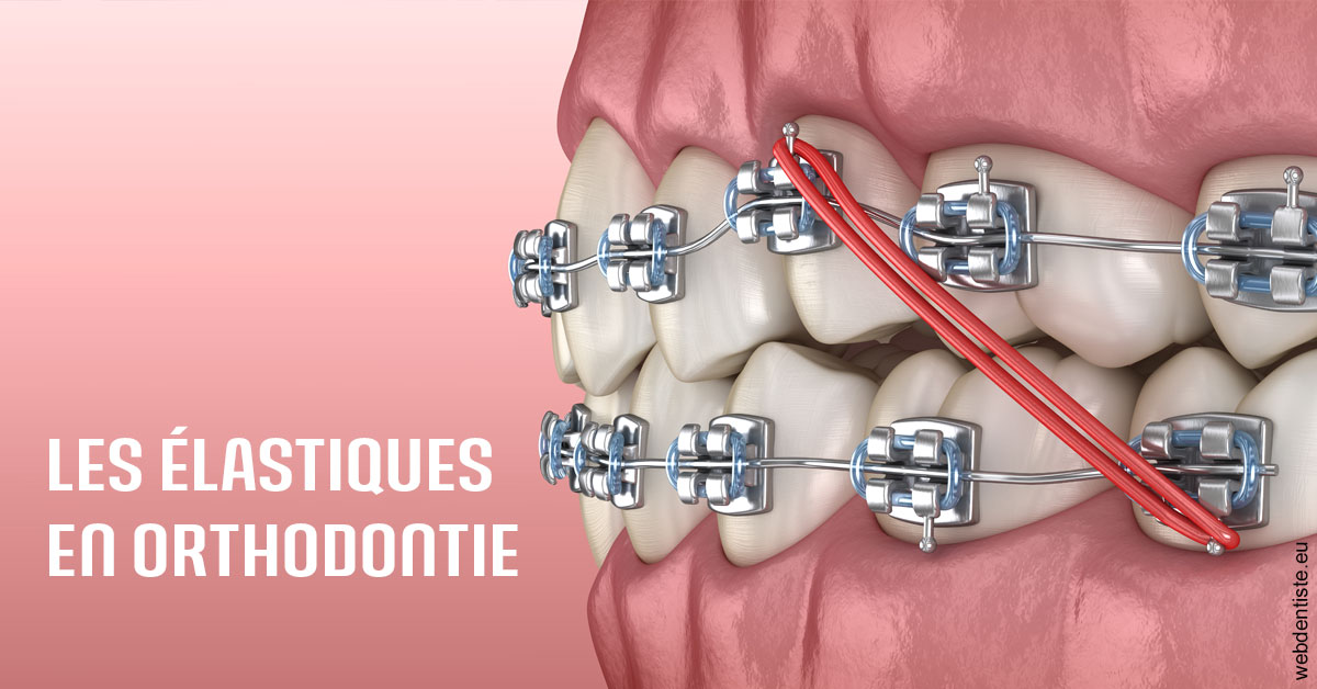 https://selarl-dr-valette-jerome.chirurgiens-dentistes.fr/Elastiques orthodontie 2