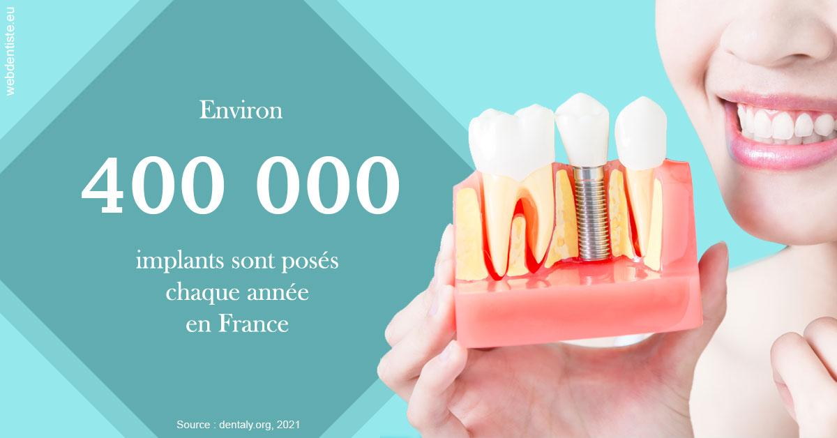 https://selarl-dr-valette-jerome.chirurgiens-dentistes.fr/Pose d'implants en France 2